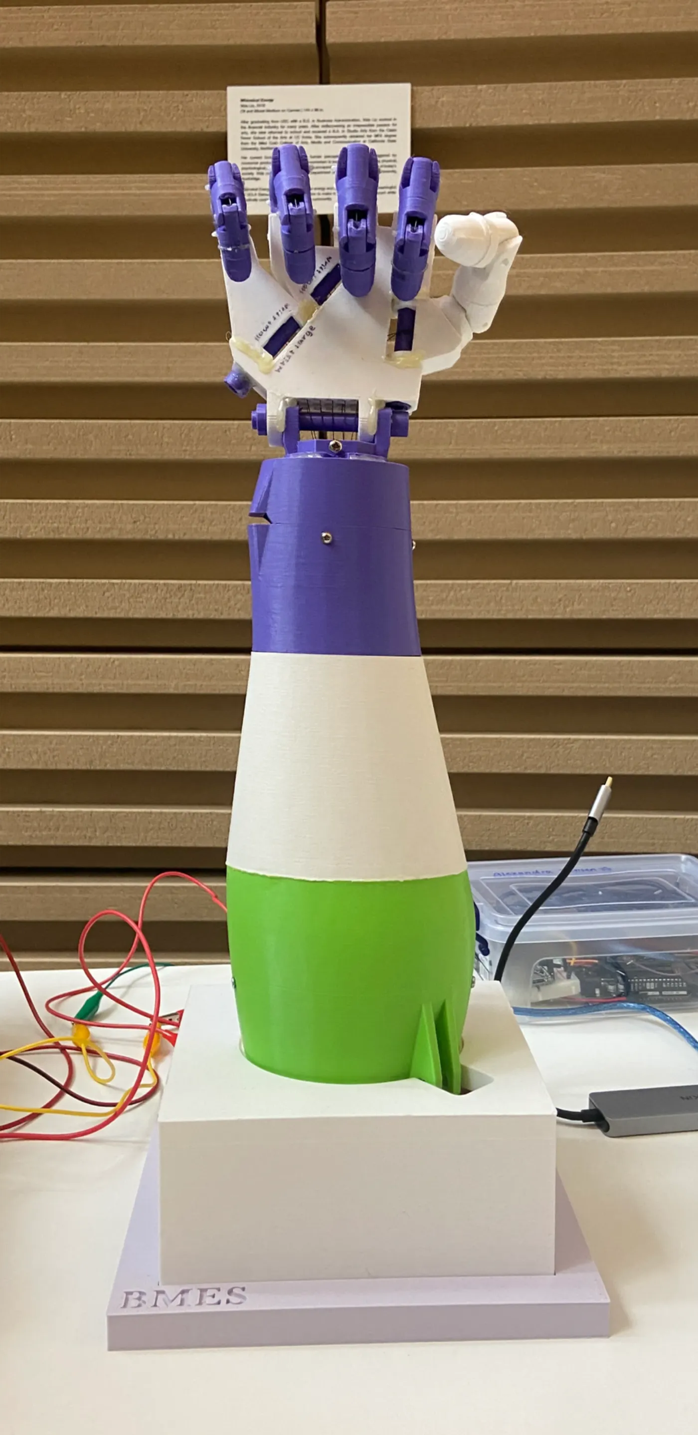 3D-printed prosthetic arm